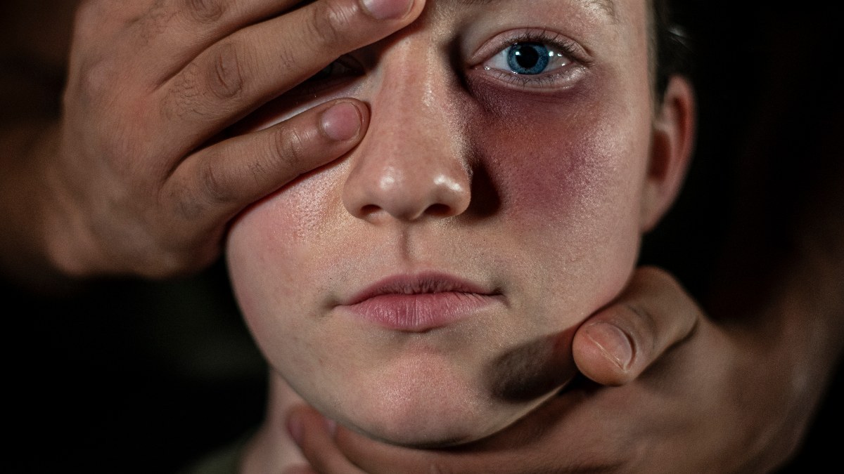 U.S. Army Spc. Catessa Palone, public affairs mass communication specialist with Armed Forces Network Europe, poses while wearing makeup to simulate a bruise for domestic violence awareness on Sembach, Germany, Nov. 15, 2019. The U.S. Department of Justic